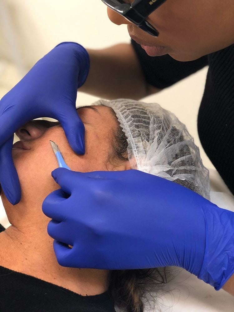 Dermaplaning