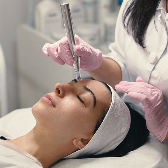 Microneedling