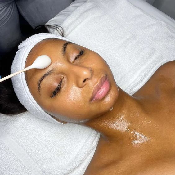 Chemical Peel (Various)